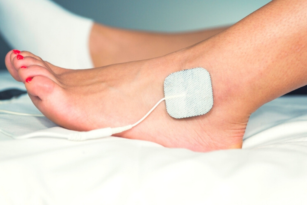tens electrical stimulation for pain and nerve regeneration